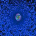 สติกเกอร์